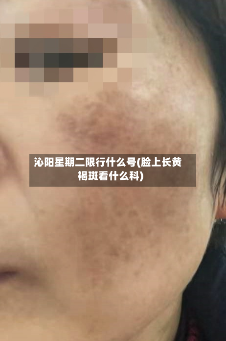 沁阳星期二限行什么号(脸上长黄褐斑看什么科)