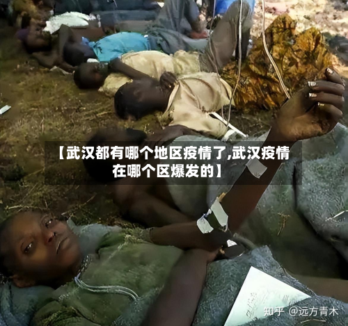 【武汉都有哪个地区疫情了,武汉疫情在哪个区爆发的】-第3张图片